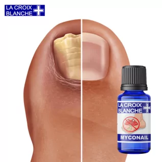 Solución MycoNail - Sinergia antihongos en las uñas