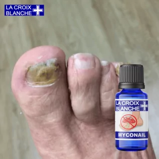 MycoNail Solution - Synergie Mycose Ongles - La Croix Blanche