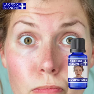 Couperose Calm, Synergie Réparatrice Naturelle - La Croix Blanche