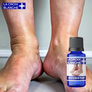 MycoStop, Synergie mycose du pied - La Croix Blanche