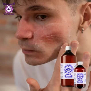 Pieles irritadas Sinergia hidrolatos Origine BiO* - Loción 200ml - OFLORALE