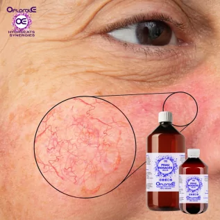 Rosacea Cilt Sinerjisi Hidrosoller Organik Kökenli* - Losyon 200ml - OFLORALE